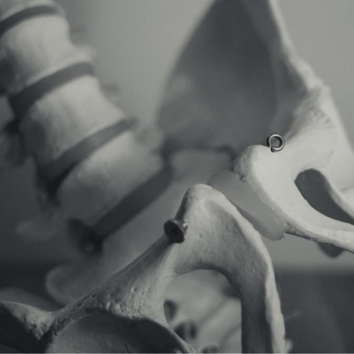 Bone Strength