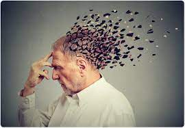 Alzheimer