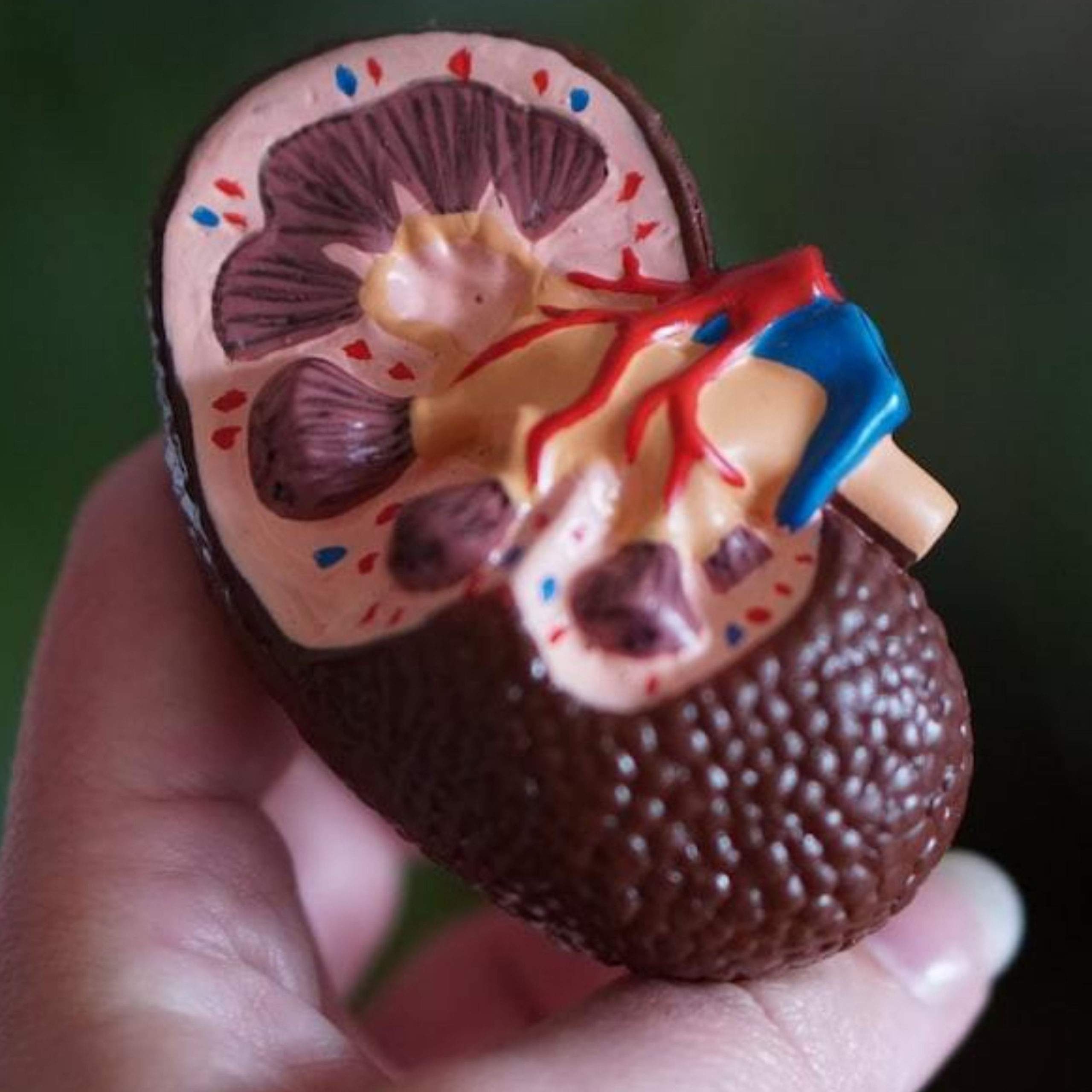 Kidney Support