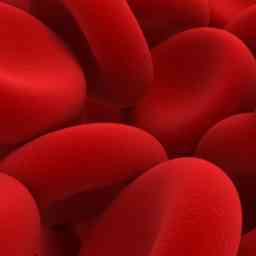 Anemia